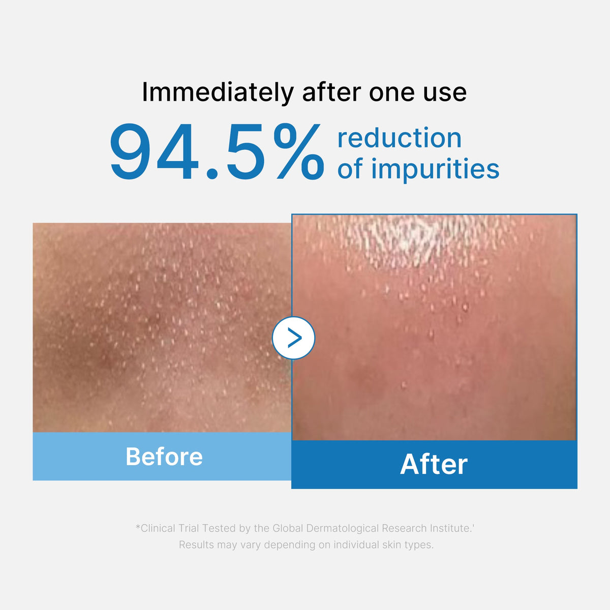 zero-pore-blackhead-deep-cleansing-oil-p8 01_eed557ec-5857-46a2-8b17-dbd67c692dcb.jpg