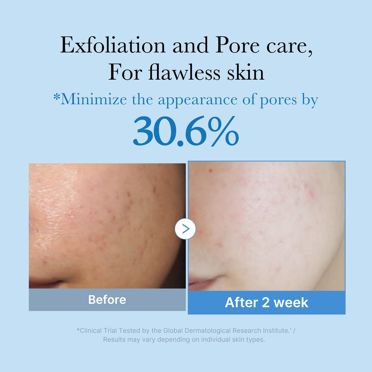 zero-pore-toner-u5 01_d6480b4e-3c08-4954-994a-ed5212c1839c.jpg