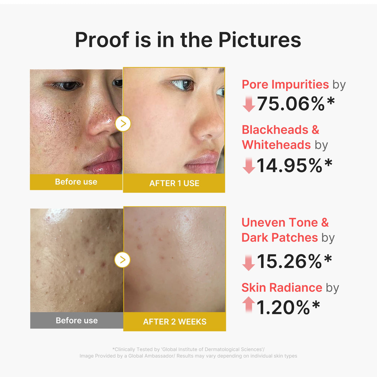 kojic-acid-turmeric-peel-shot-t0 02_45fe66d3-b3f6-4100-aa52-2afd7eded417.jpg