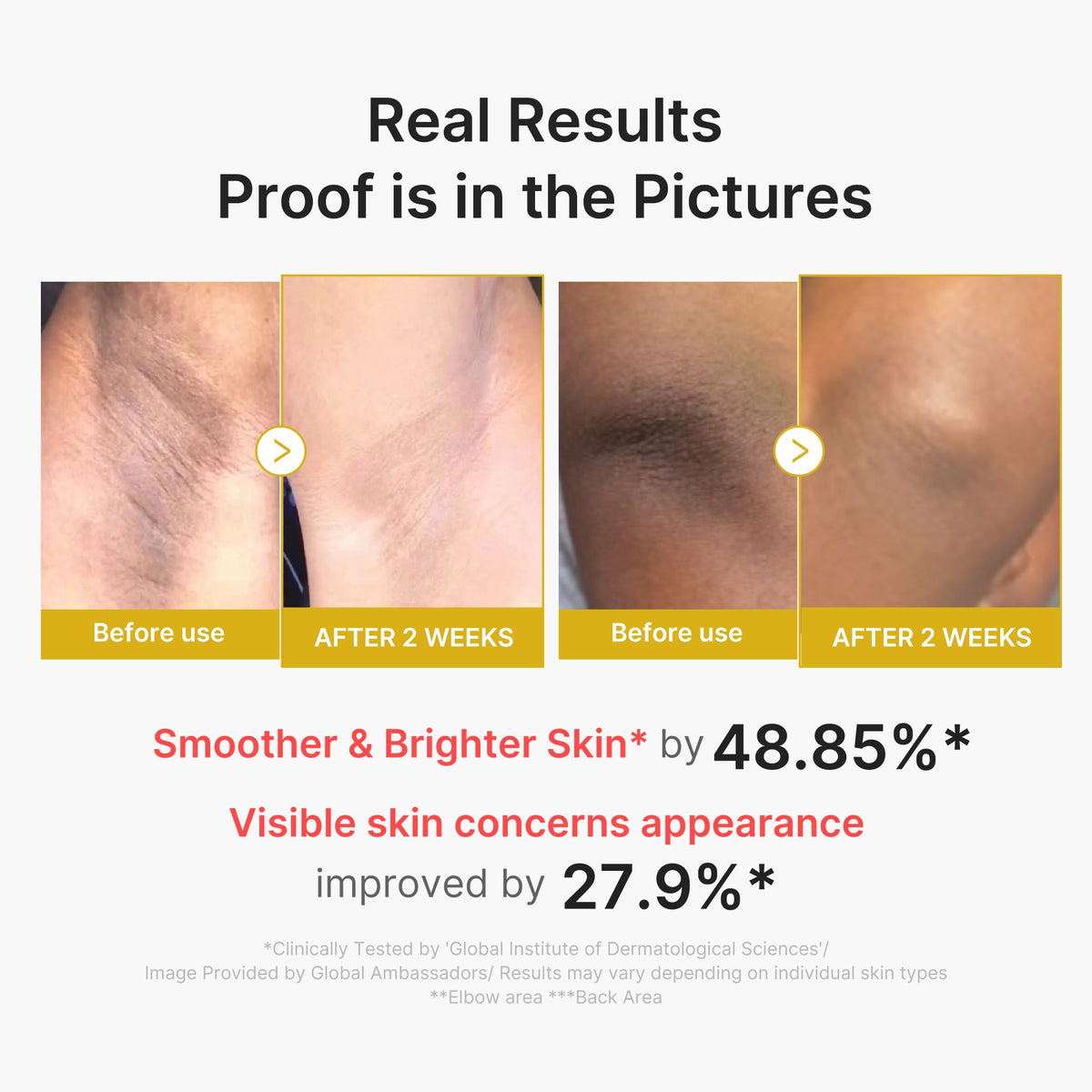 kojic-acid-turmeric-body-peel-shot-s8 02_72880cfc-382b-440b-8152-7e3dce87da2a.jpg
