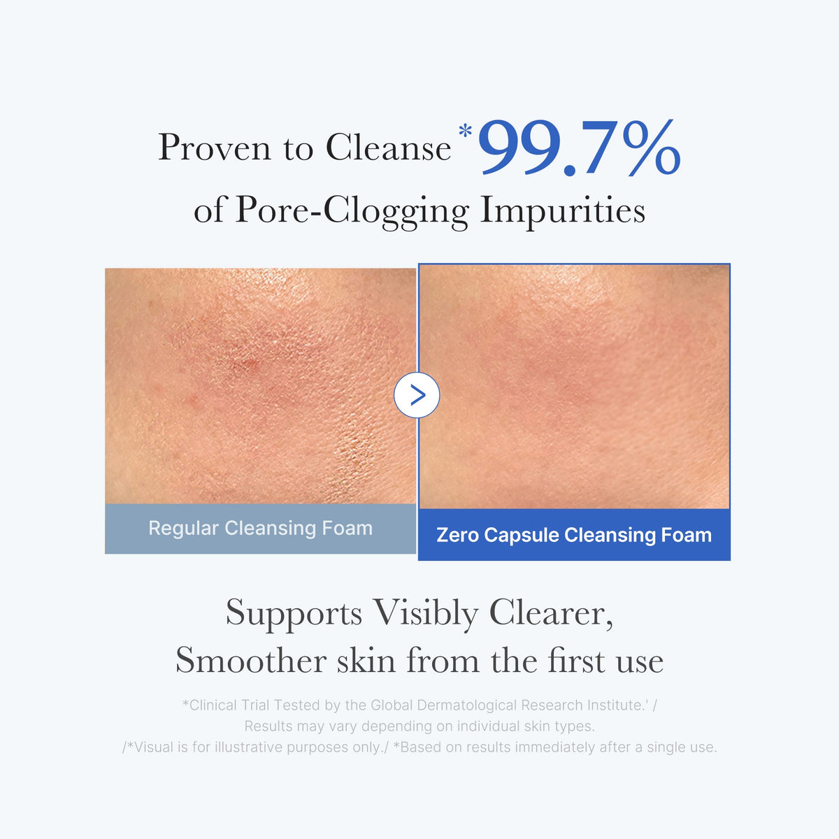 zero-pore-capsule-cleansing-foam-d9 02_c1fb9dfb-86c5-4038-8ff8-490d1006276c.jpg