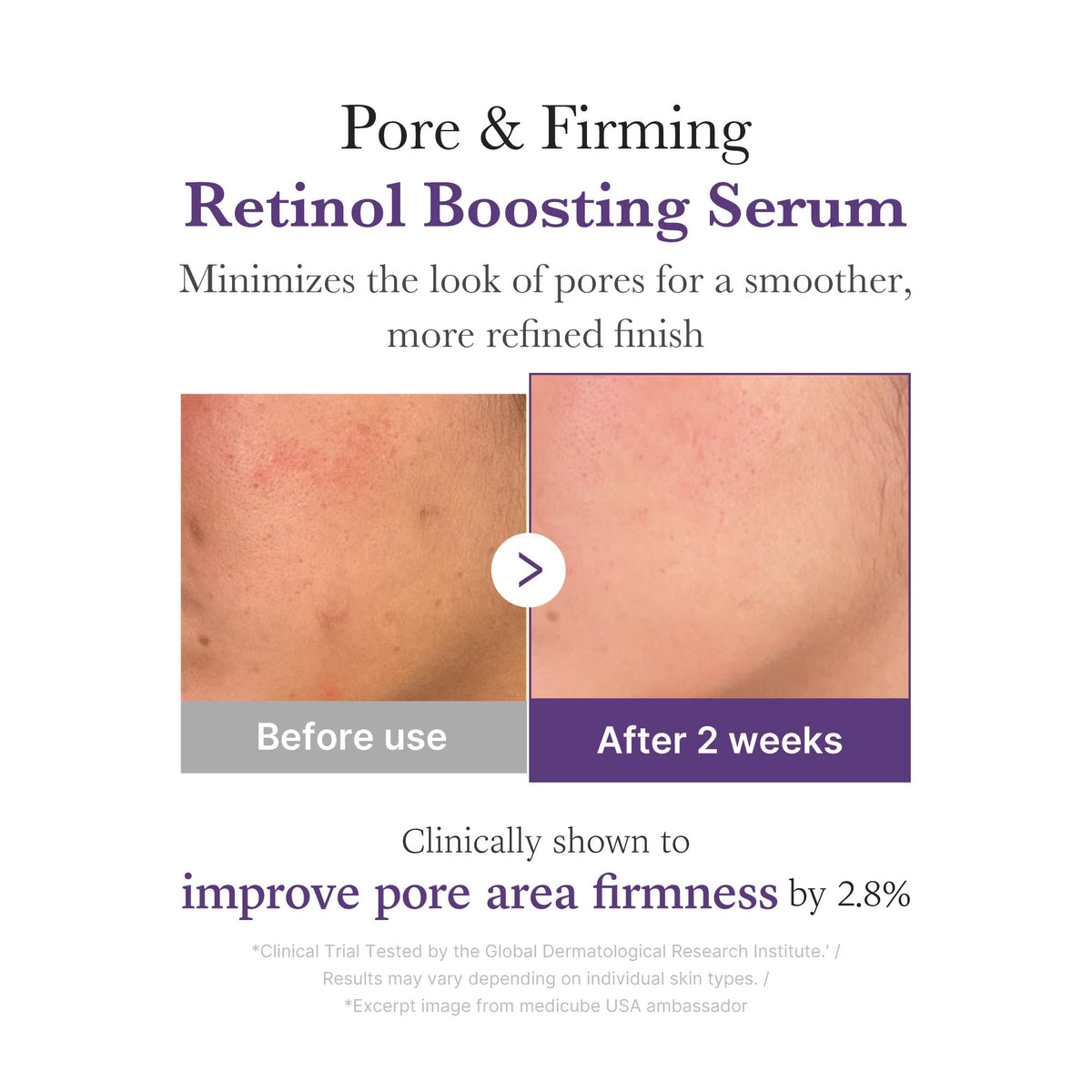 retinol-nmn-boosting-serum-u8 03_3510e7a5-5633-4a18-81ea-1389593bd517.jpg