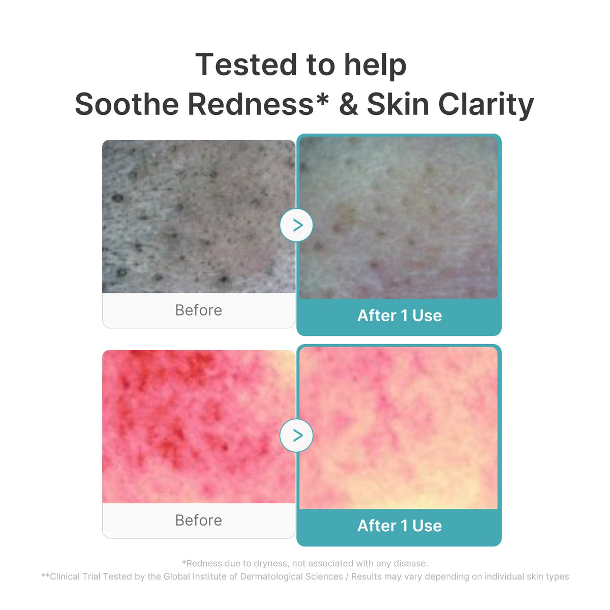 azelaic-acid-capsule-foam-cleanser-o1 03_4aa17579-07e7-4c56-a0cc-f677ec39e4ee.jpg