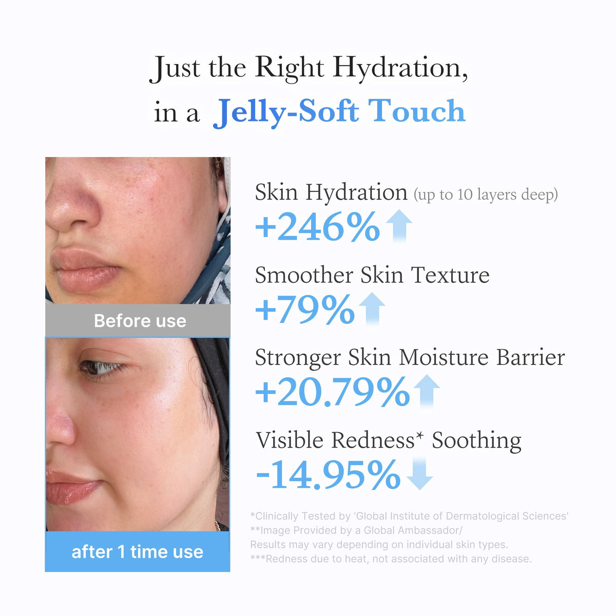 hyaluronic-ceramide-moisturizing-jelly-cream-e3 03_c39d66cc-0839-4e48-ab4a-d32143d06b1c.jpg