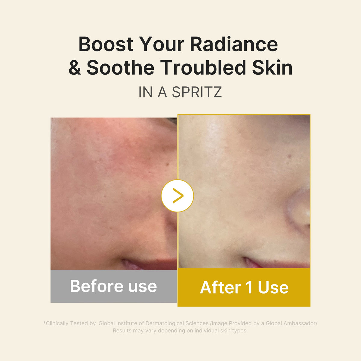kojic-acid-turmeric-vitamin-gold-jelly-mist-serum-r5 03_dc9cd19e-4e57-49d3-9b66-c7762e8a63f1.jpg