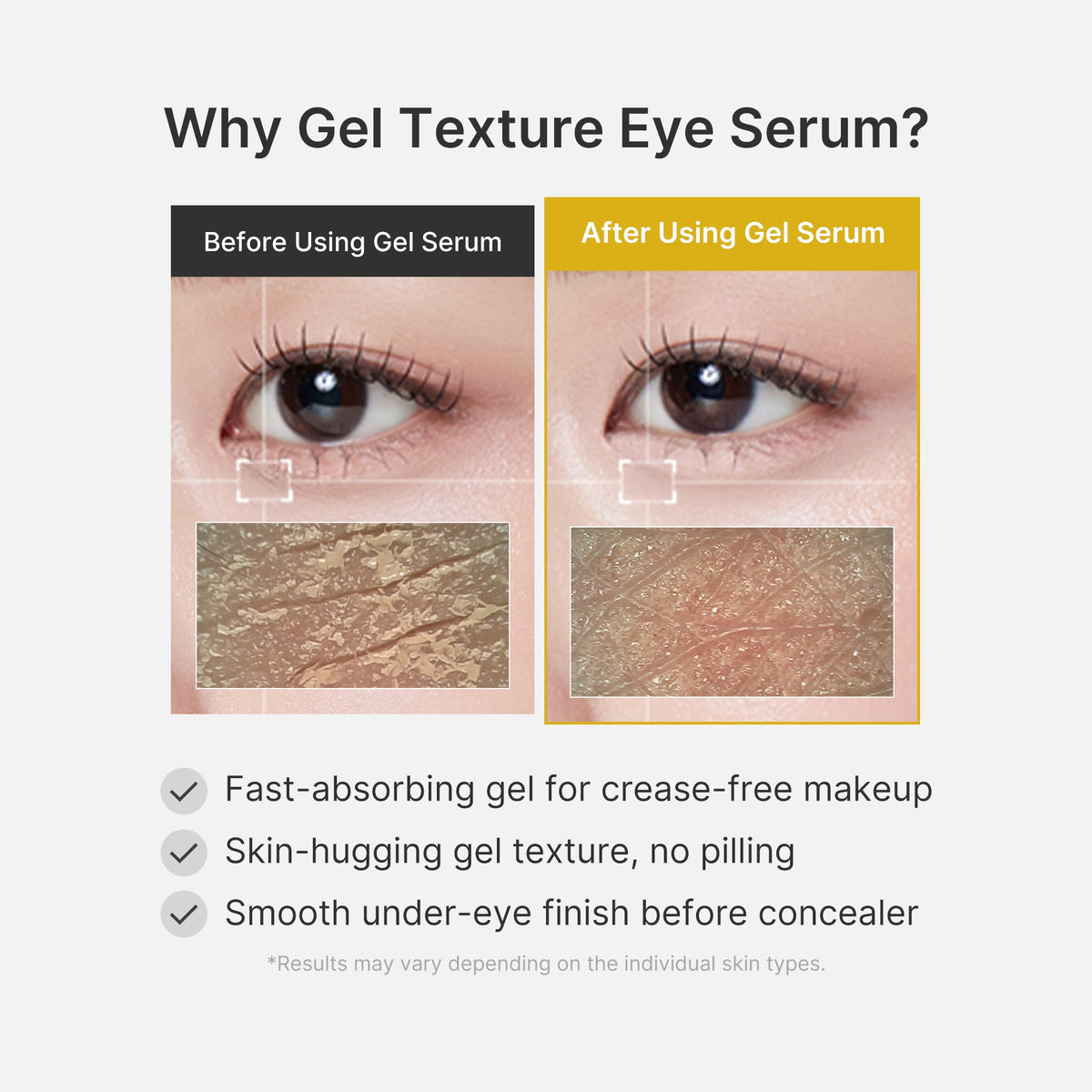 kojic-acid-tumeric-eye-gel-serum-b1 04_0487ef36-49f4-4294-8049-bb55118b05fe.jpg