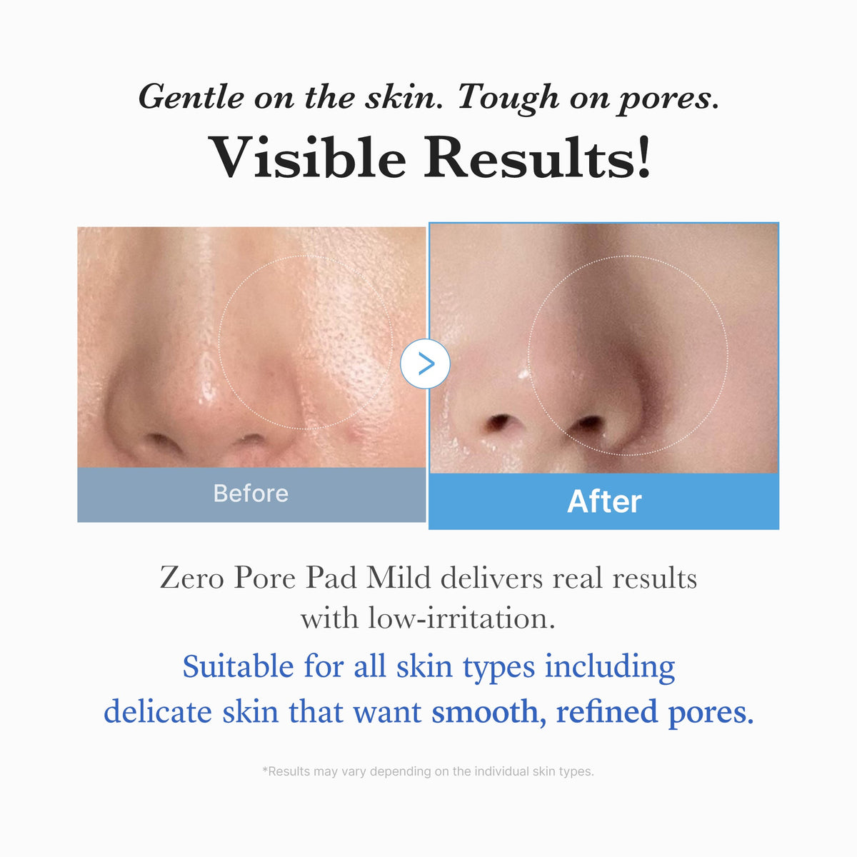 zero-pore-madecassoside-pads-mild-x4 04_6357f9f9-483b-4891-82c6-a58d336e62c8.jpg