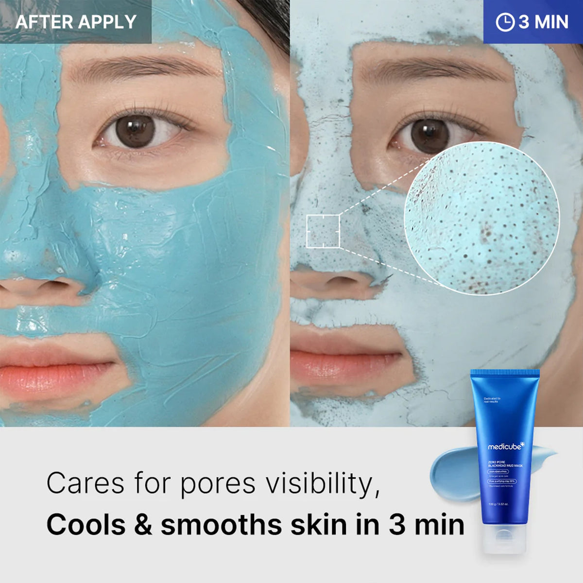zero-pore-blackhead-mud-mask-t5 04_867c0459-a94e-40d3-bd9a-70400edabe8d.jpg