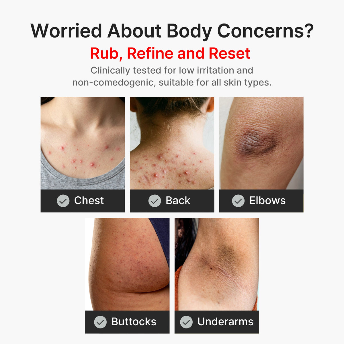 kojic-acid-turmeric-body-peel-shot-s8 04_8a7237f2-3ebf-401e-bd85-54841aeb3efc.jpg