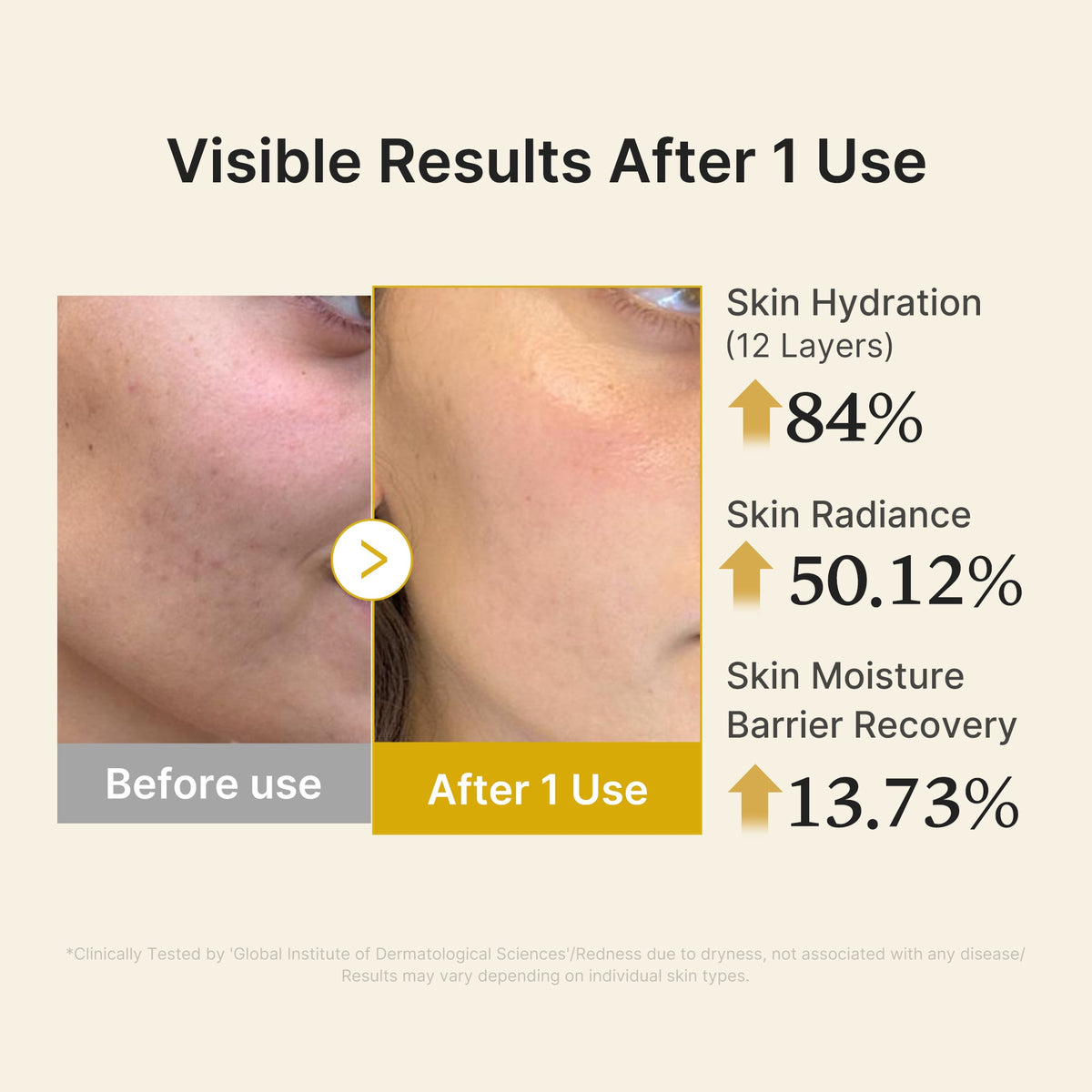 kojic-acid-turmeric-vitamin-gold-jelly-mist-serum-r5 04_d5c55ef1-e03b-494d-bc0d-a1ecc7fc2abf.jpg