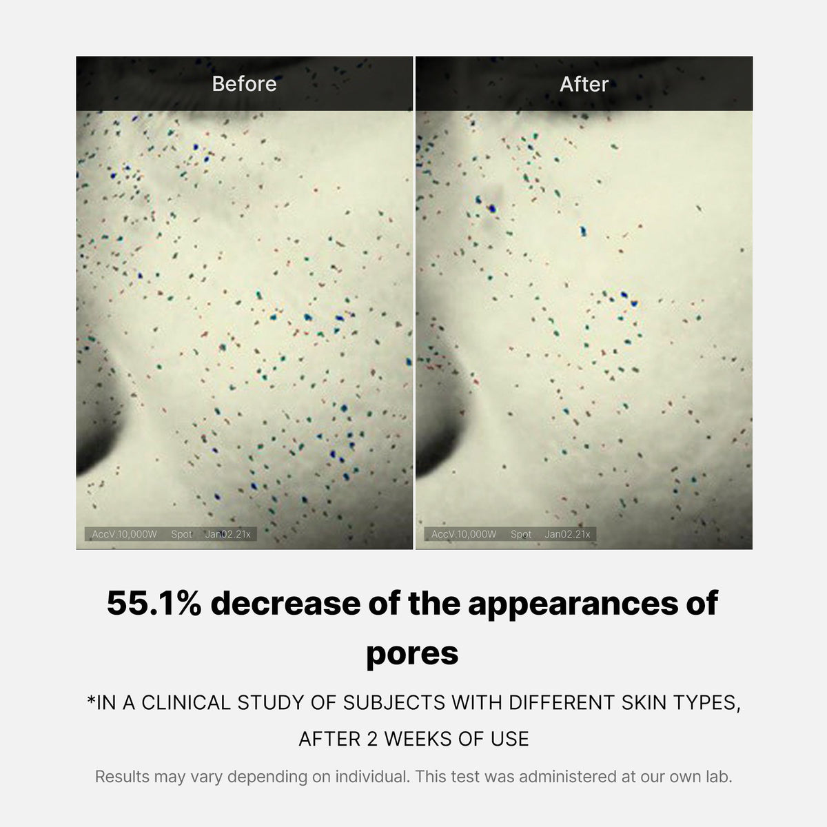 pore-care-duo-l1 05_12ddab8a-64be-4612-8ee1-27e5ec701921.jpg