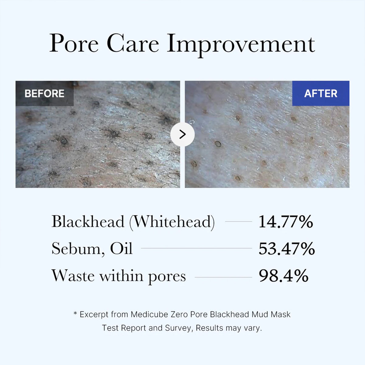 zero-pore-blackhead-mud-mask-d7 05_9362a158-c2b3-4525-acc0-631a2cfdea47.jpg