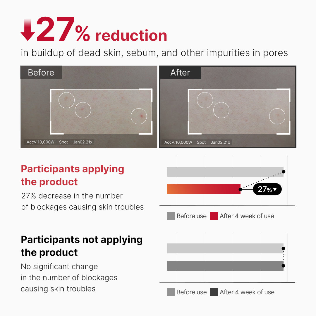 red-body-peeling-shot-cleanser-u4 07_60b5b2fd-b0f0-4cae-b358-5c38181e8dd8.jpg