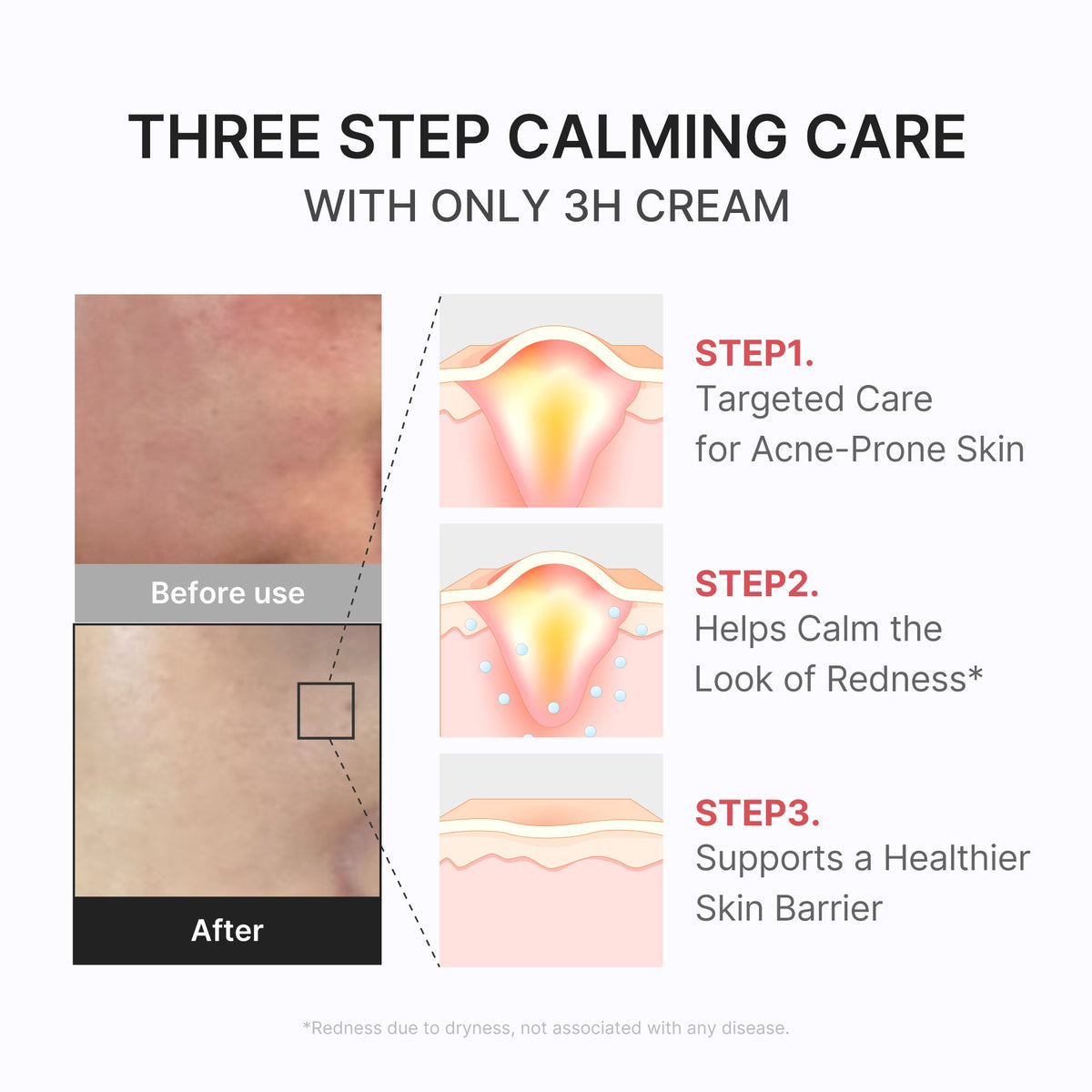 3h-daily-relief-cream-m7 3H_04.jpg