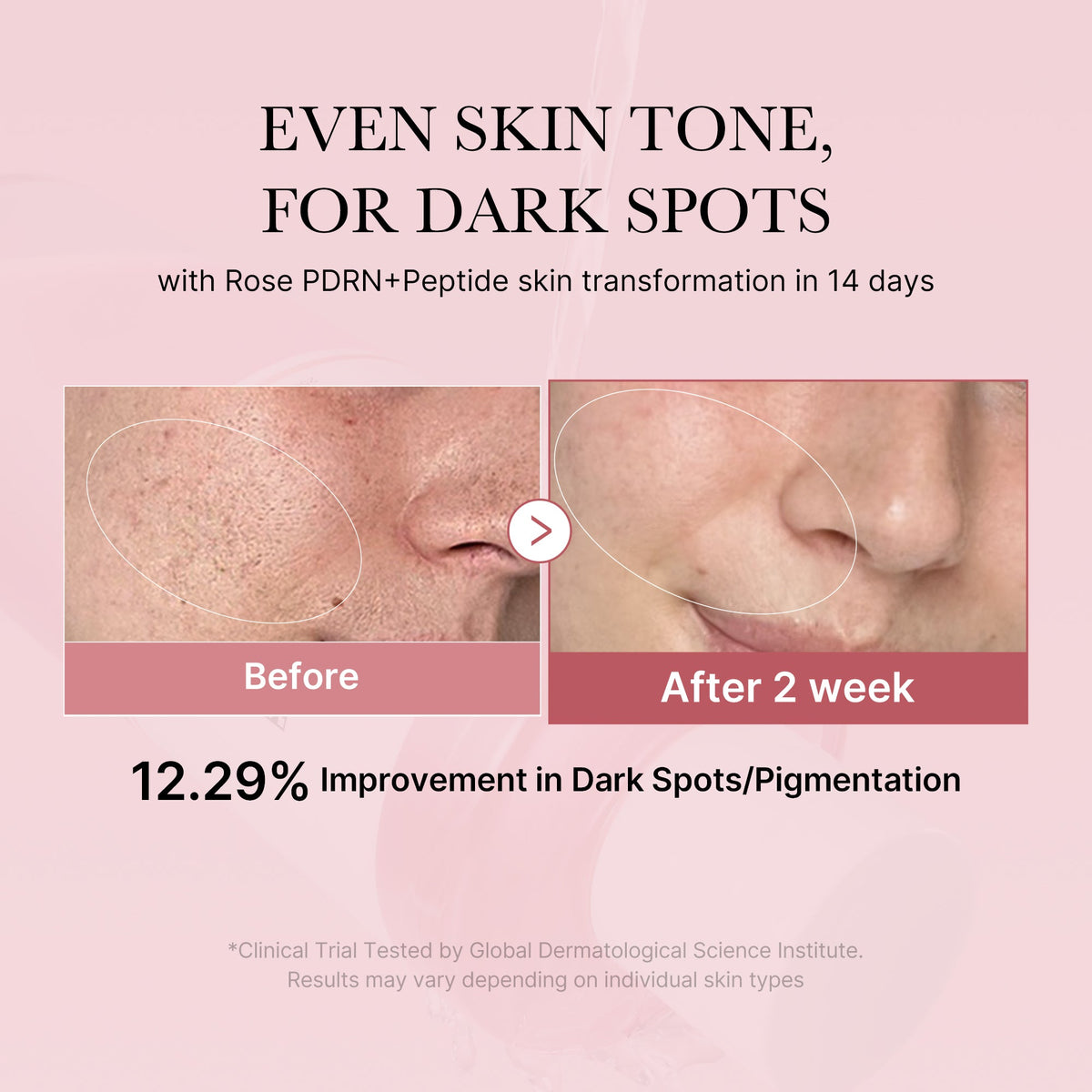 pdrn-pink-peptide-toner-a4 PDRN_01_308c518e-5ac6-4e54-99bd-eabc8796739b.jpg