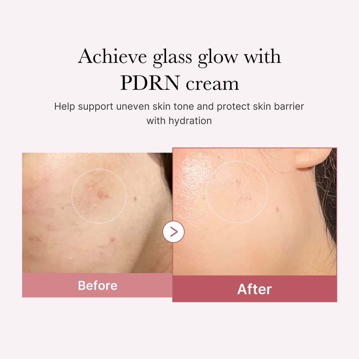 pdrn-pink-peptide-cream-d2 PDRN_02_d7805bfe-cf43-446a-b71b-a276683f136b.jpg