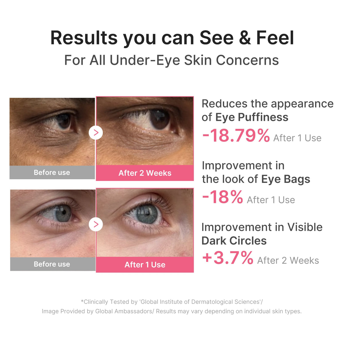 pdrn-caffeine-collagen-eye-patch-b1 PDRN_03_cdce2143-b8d8-43cb-ac69-fcbdf6640249.jpg