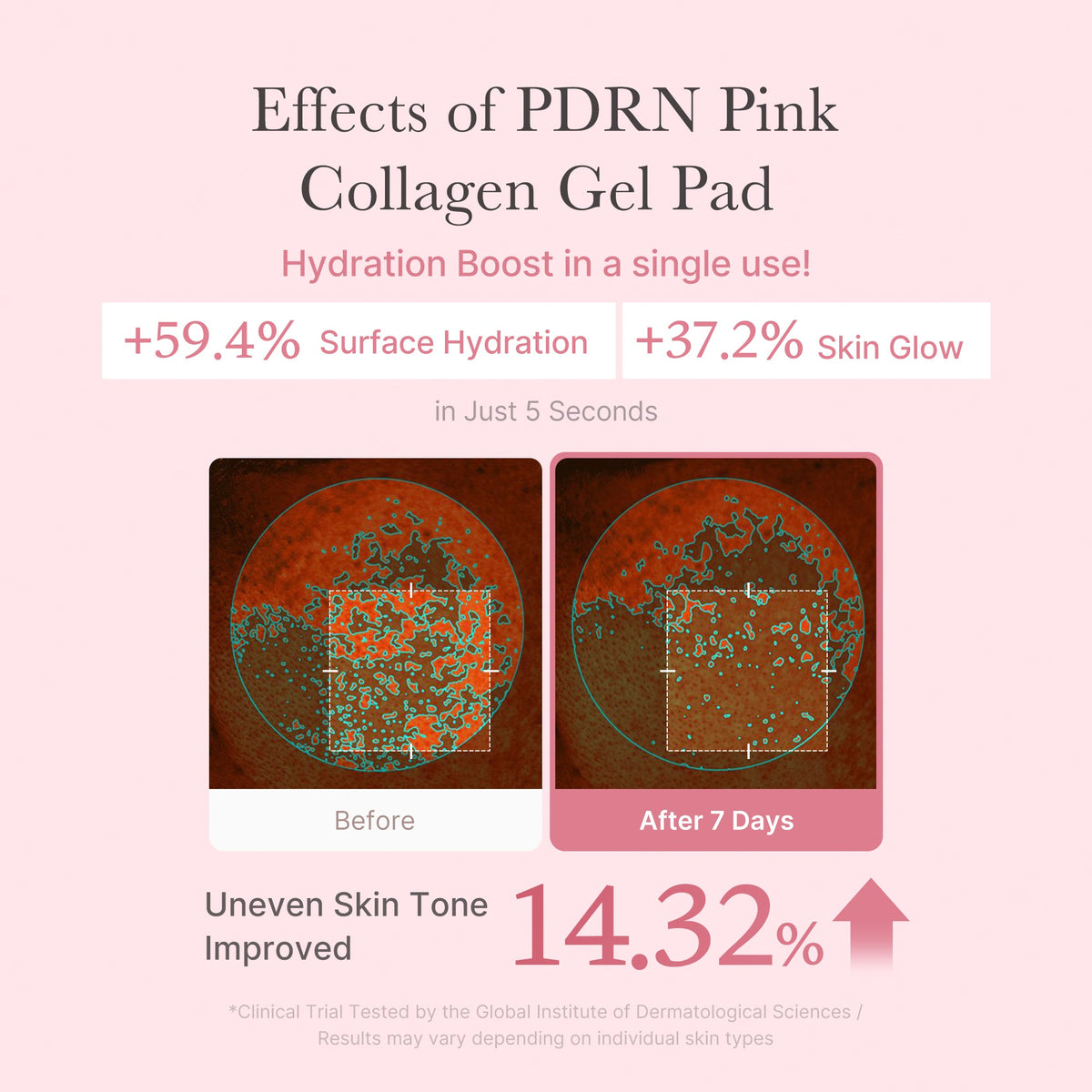 pdrn-pink-collagen-gel-toner-pad-v5 PDRN_04_f9a16a56-8d9e-4c47-a635-ed34ec3ed571.jpg