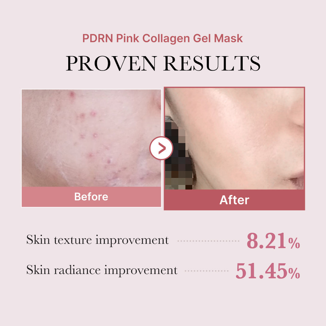 pdrn-pink-glow-full-set-f4 PDRN_12.jpg