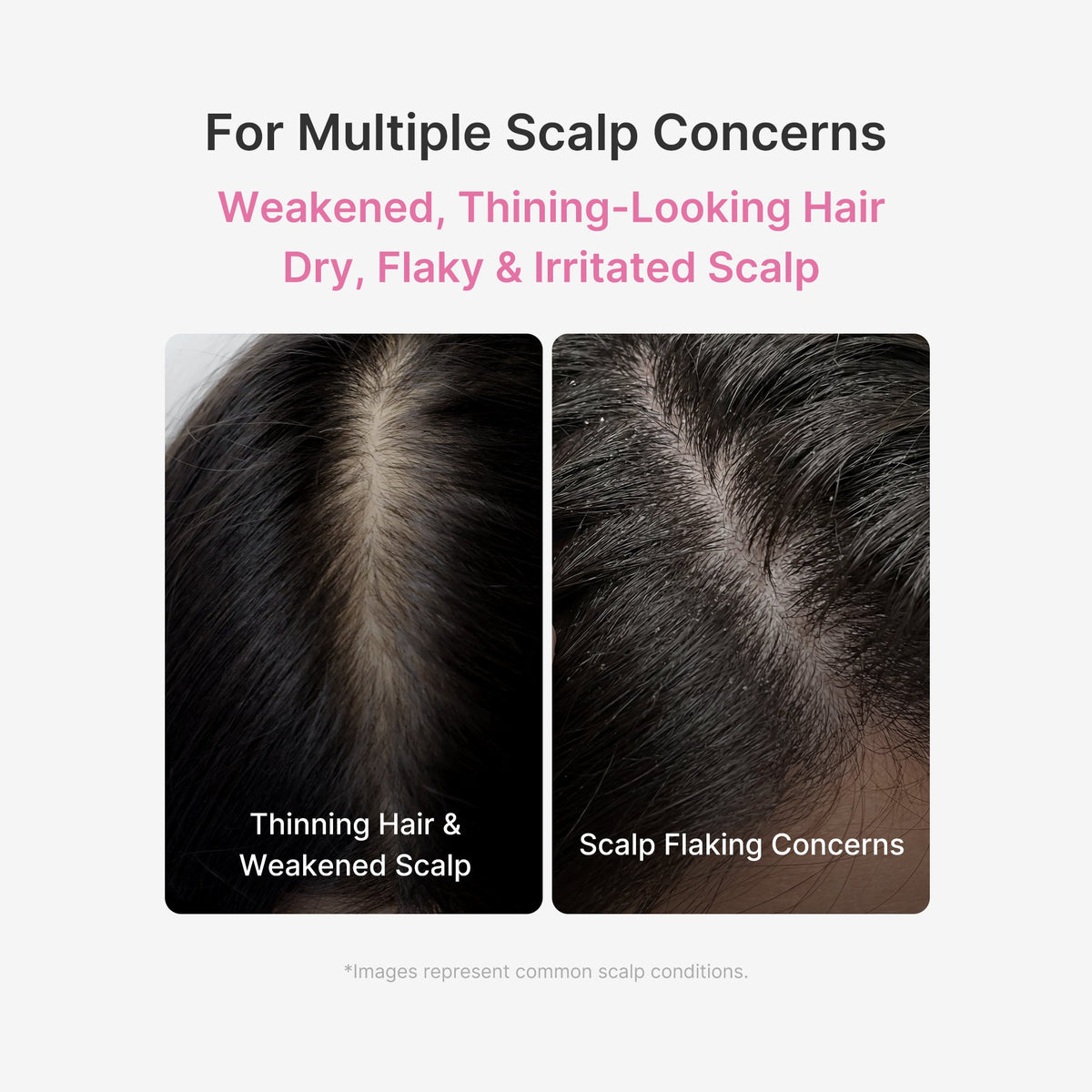 rosemary-pdrn-scalp-serum-d2 US_ME_RosemaryAmpoule_th02.jpg